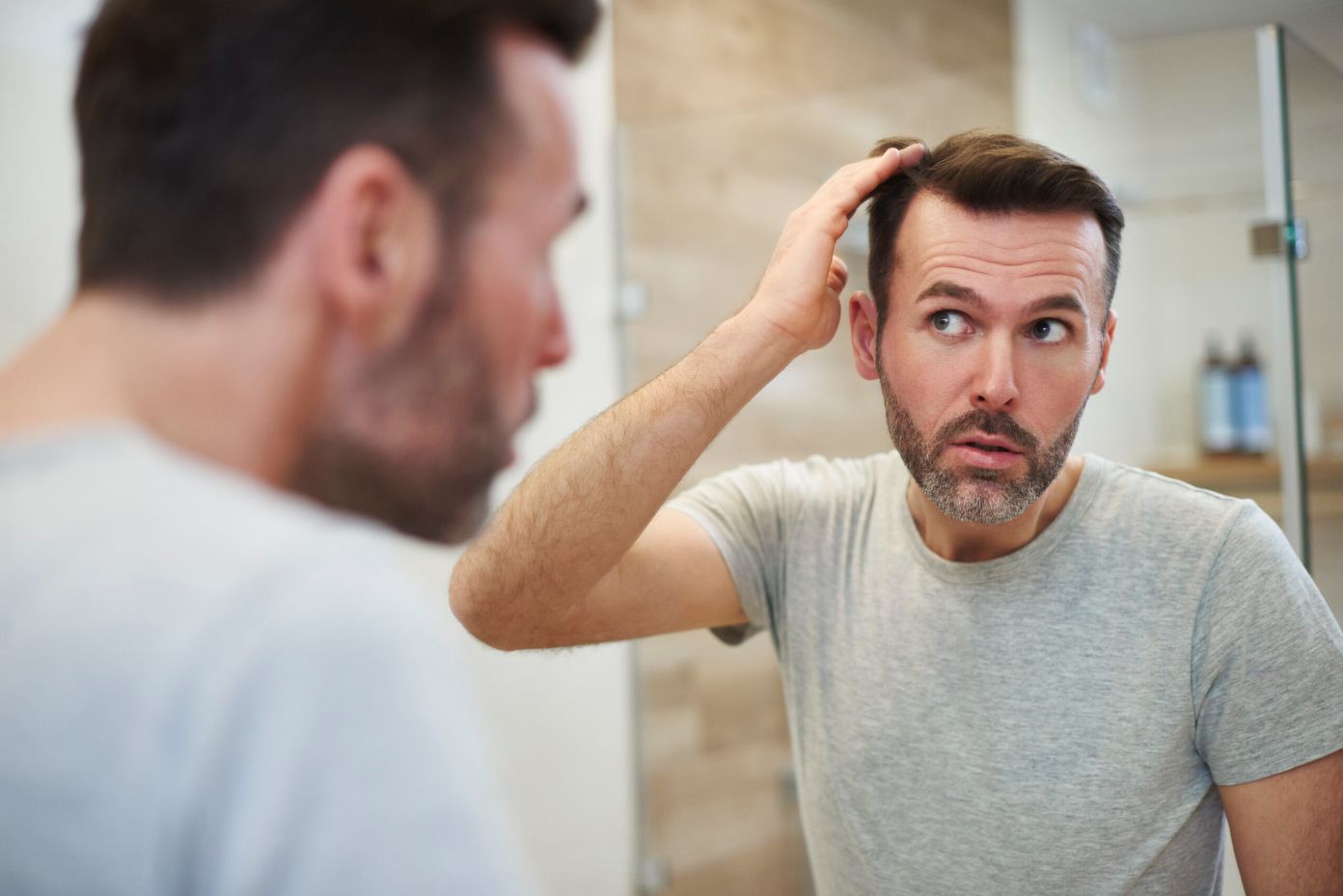 different types of hair loss