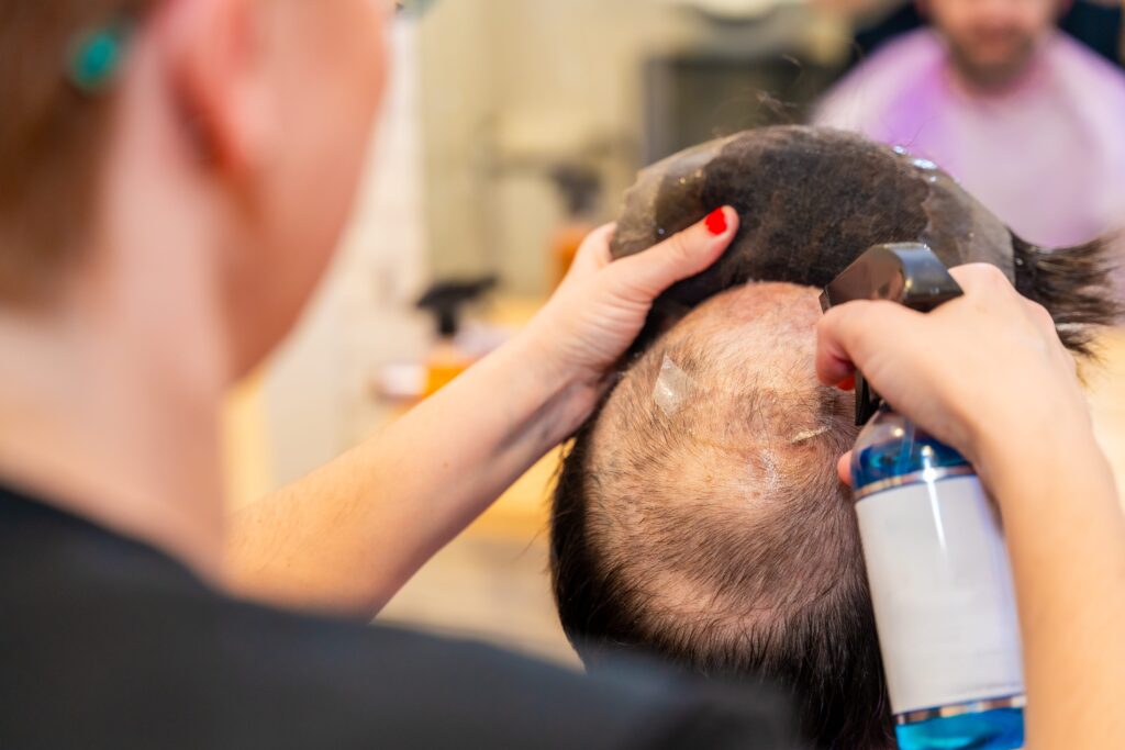 In a salon setting, a person is applying spray to a partially bald head, enhancing the look just as good synthetic wigs can.
